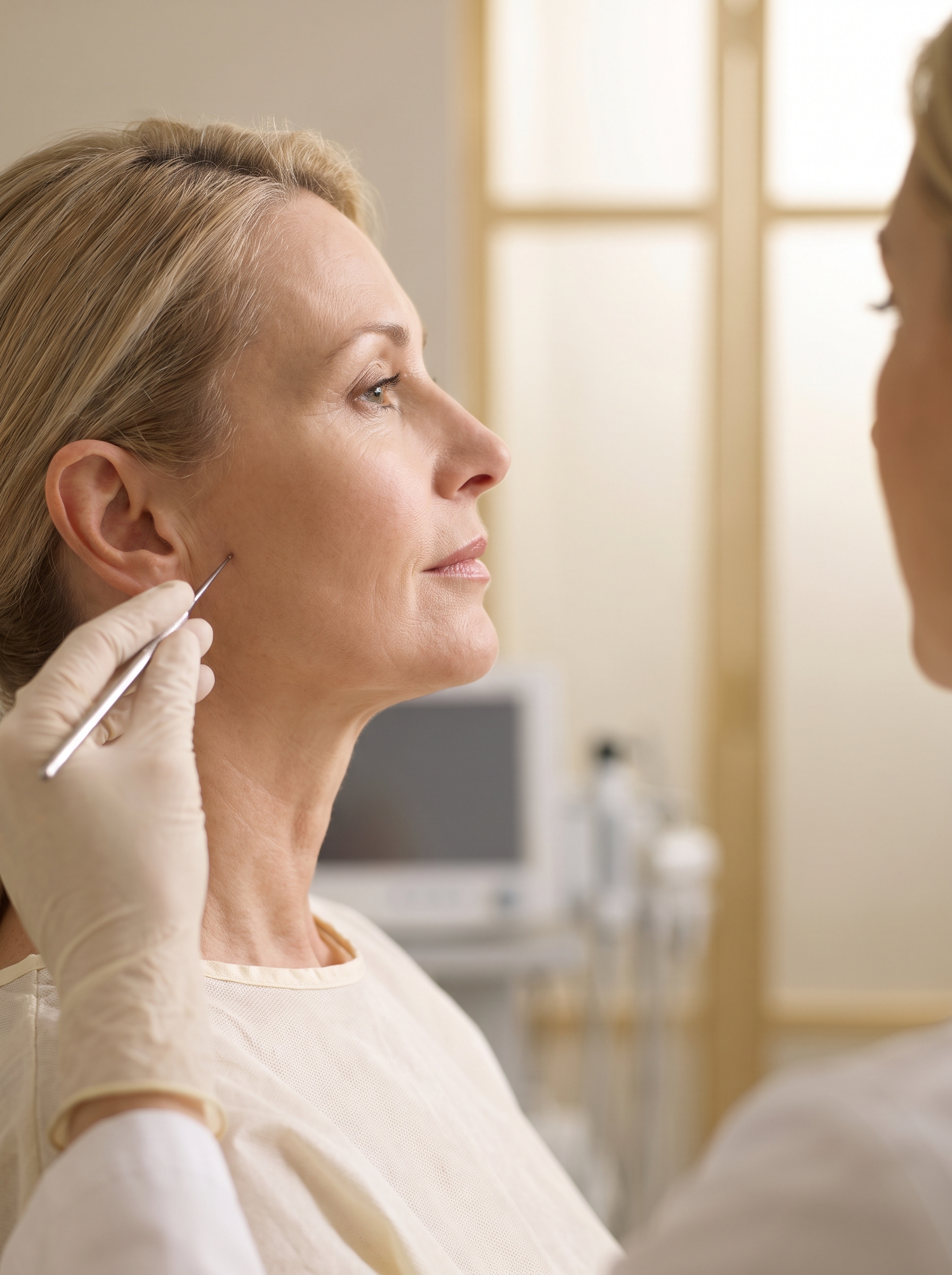 Ficha del tratamiento: Thread Facial Lift (Hilos Tensores)